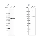 Western blot analysis using Anti-TF antibody HPA001527 (A) shows similar pattern to independent antibody HPA005692 (B).