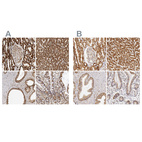 Anti-ATP5B Antibody