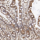 Immunohistochemical staining of human small intestine shows moderate granular cytoplasmic positivity in glandular cells.