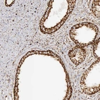 Immunohistochemical staining of human prostate shows strong granular cytoplasmic positivity in glandular cells.