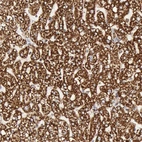 Immunohistochemical staining of human liver shows strong granular cytoplasmic positivity in hepatocytes.