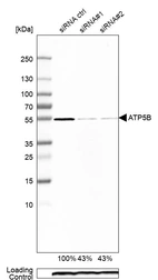 Western blot analysis in A-549 cells transfected with control siRNA, target specific siRNA probe #1 and #2, using Anti-ATP5B antibody. Remaining relative intensity is presented. Loading control: Anti-PPIB.