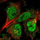 Anti-ARMCX3 Antibody