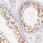 Anti-RBMY1A1 Antibody