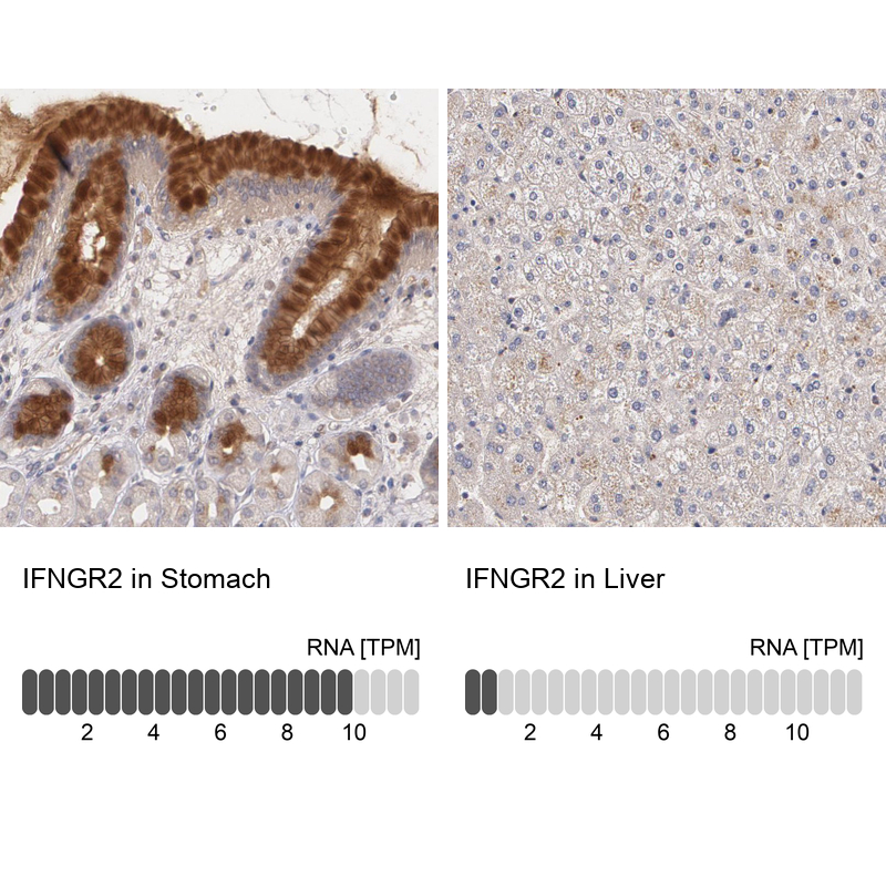 Anti-IFNGR2 Antibody