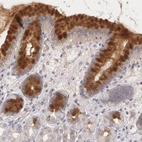 Immunohistochemical staining of human stomach shows high expression.
