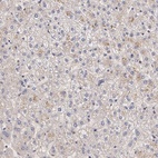 Immunohistochemical staining of human liver shows low expression as expected.
