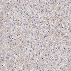 Anti-IFNGR2 Antibody