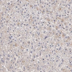 Immunohistochemical staining of human liver shows low expression as expected.