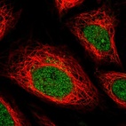 Immunofluorescent staining of human cell line SiHa shows localization to nucleoplasm & the Golgi apparatus.
