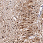 Anti-STX8 Antibody