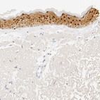 Anti-LGALS7 Antibody