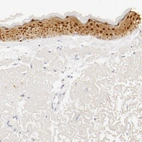 Anti-LGALS7 Antibody