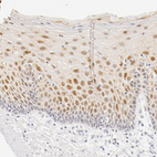 Immunohistochemical staining of human cervix, uterine shows positivity in squamous epithelial cells.