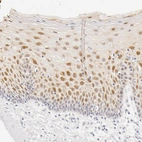 Immunohistochemical staining of human cervix, uterine shows positivity in squamous epithelial cells.