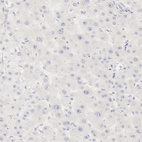 Anti-LGALS7 Antibody