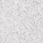 Immunohistochemical staining of human liver shows no positivity in hepatocytes as expected.