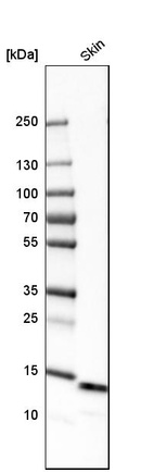 Anti-LGALS7 Antibody