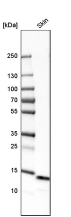 Western blot analysis in human skin tissue.