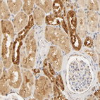 Immunohistochemical staining of human kidney shows moderate positivity in cells in tubules.