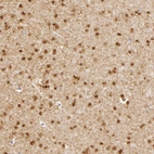 Immunohistochemical staining of human cerebral cortex shows strong nuclear positivity in glial cells.