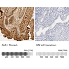 Immunohistochemistry analysis in human stomach and endometrium tissues using HPA001550 antibody. Corresponding CA2 RNA-seq data are presented for the same tissues.