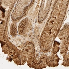 Immunohistochemical staining of human stomach shows strong cytoplasmic and nuclear positivity in glandular cells.