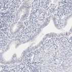 Immunohistochemical staining of human endometrium shows no positivity in glandular cells as expected.