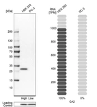 Western blot analysis in human cell lines HEK293 and PC-3 using Anti-CA2 antibody. Corresponding CA2 RNA-seq data are presented for the same cell lines. Loading control: Anti-PPIB.