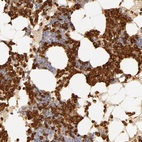 Anti-C1R Antibody