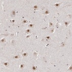 Anti-INTS6 Antibody