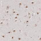Anti-INTS6 Antibody