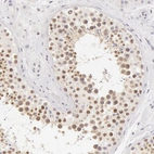 Anti-ZNF597 Antibody