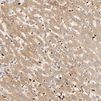 Anti-AGT Antibody