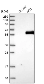Western blot analysis in control (vector only transfected HEK293T lysate) and AGT over-expression lysate (Co-expressed with a C-terminal myc-DDK tag (~3.1 kDa) in mammalian HEK293T cells, LY400005).