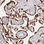 Anti-ATF3 Antibody