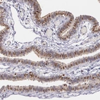 Immunohistochemical staining of human fallopian tube shows moderate nuclear positivity in a subset of glandular cells with weak cytoplasmic positivity.