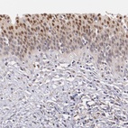 Immunohistochemical staining of human urinary bladder shows moderate nuclear positivity in epithelial cells with weak cytoplasmic positivity.
