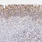 Immunohistochemical staining of human urinary bladder shows moderate nuclear positivity in epithelial cells with weak cytoplasmic positivity.