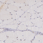 Immunohistochemical staining of human skeletal muscle shows very weak nucleus-cytoplasmic positivity in myocytes.