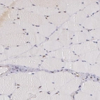 Immunohistochemical staining of human skeletal muscle shows very weak nucleus-cytoplasmic positivity in myocytes.
