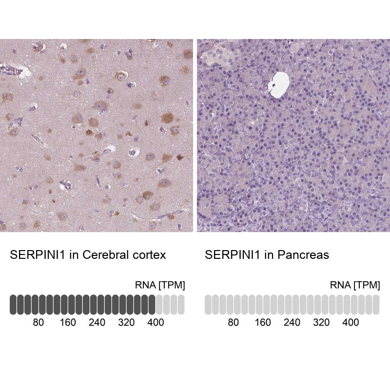 Anti-SERPINI1 Antibody