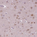 Immunohistochemical staining of human cerebral cortex shows high expression.