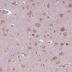 Anti-SERPINI1 Antibody