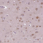 Immunohistochemical staining of human cerebral cortex shows high expression.