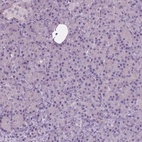 Anti-SERPINI1 Antibody