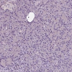 Immunohistochemical staining of human pancreas shows low expression as expected.