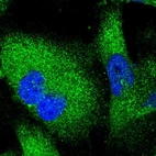 Immunofluorescent staining of human cell line U-251 MG shows localization to cytosol.