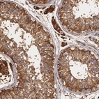 Anti-CYB5R3 Antibody