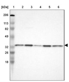 Lane 1: Marker [kDa] 206, 113, 82, 49, 32, 26, 18_br/_Lane 2: Human cell line RT-4_br/_Lane 3: Human cell line U-251MG sp_br/_Lane 4: Human cell line A-431_br/_Lane 5: Human liver tissue_br/_Lane 6: Human tonsil tissue